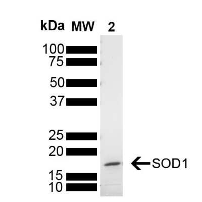 SDS-PAGE: Recombinant Human SOD1/Cu-Zn SOD Active, Monomer Protein [NBP3-14782]